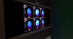 12.3" Mini LED Local Dimming Backlight LCD
